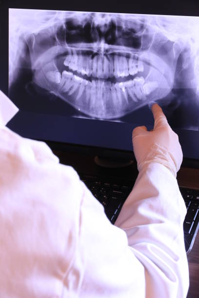 Best Emergency Tooth Extraction in New Mford, IL