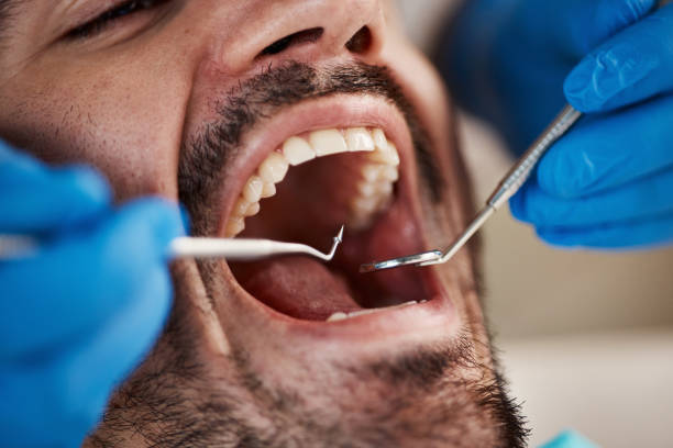 Best Walk-In Emergency Dentist in New Mford, IL