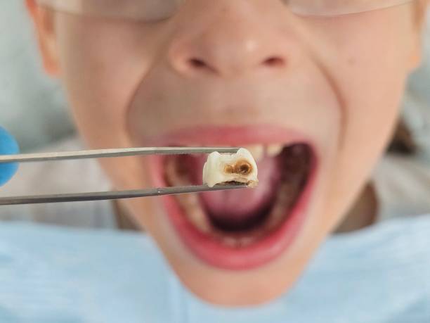 Best Emergency Treatment for Toothache in New Mford, IL